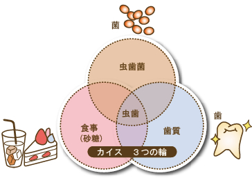 虫歯と歯周病について